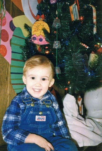 Photo of Andrew (Dec 1988) at the in-home daycare center - he has stitches by his left eye due to falling from Acute Cerebellar Ataxia